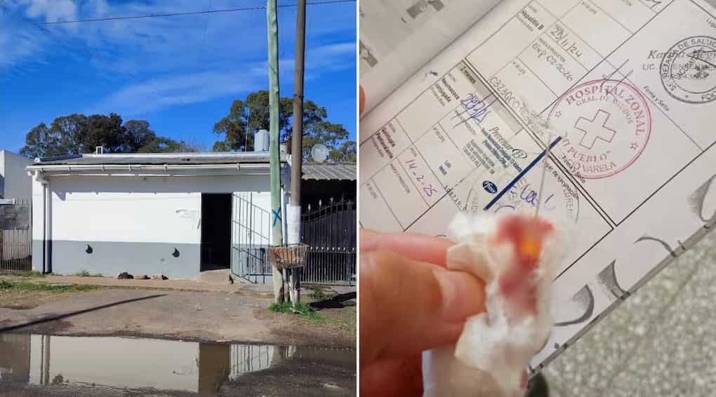 Una mujer llevó a vacunar a su bebé a una salita y denunció que le dejaron la aguja clavada en la pierna