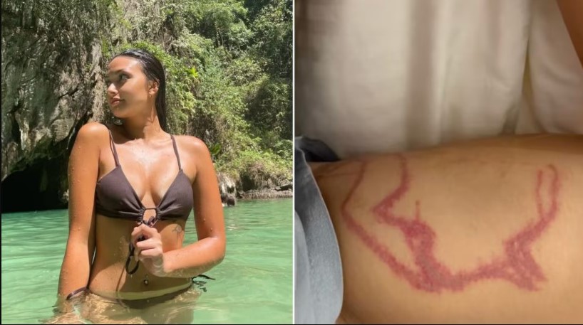 Una influencer estuvo al borde de la muerte tras ser atacada por una medusa venenosa